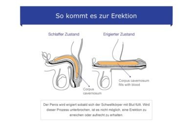 Wie entsteht eine Erektion?