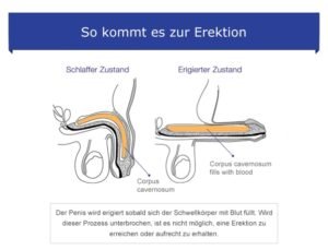 Die Erektion