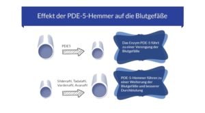 So wirkt der PDE-5-Hemmer Viagra