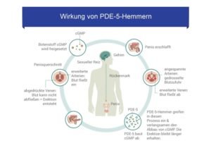 Der PDE-5-Hemmer Viagra Original von Pfizer