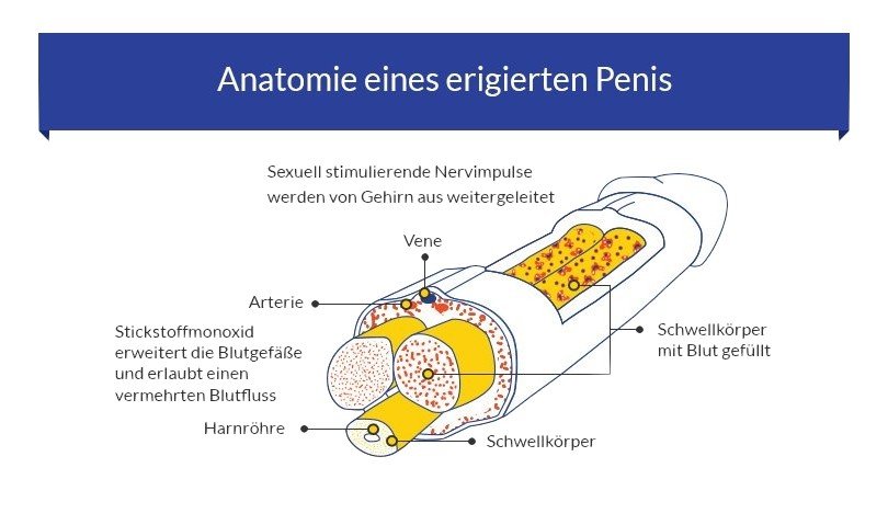 Ursachen von Erektionsproblemen