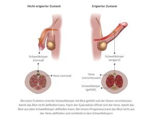 So kommt es zur Erektion